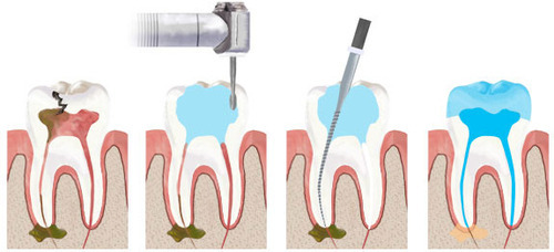 Endodontija-1 Endodontija-1