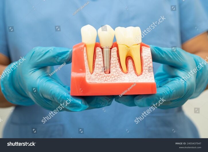 implantat- 2455437547
