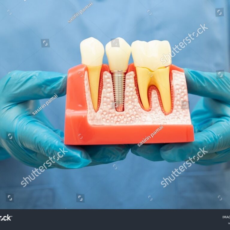 implantat- 2455437547