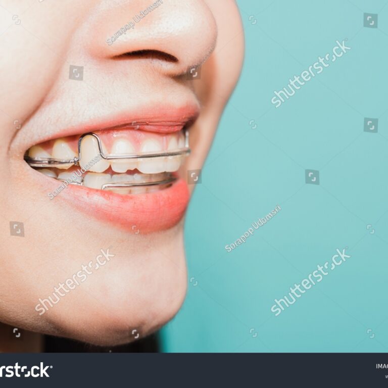 snemljivi-2142348621